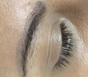 Vor der Korrekturbehandlung