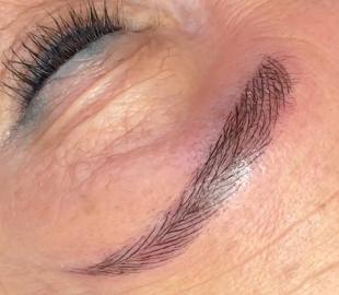 Directly after treatment